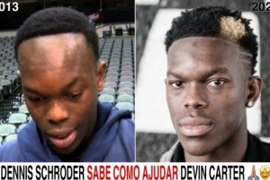 网友晒施罗德发际线逆生长对比图调侃德文-卡特 :他知道怎么帮你 网友晒施罗德发际线逆生长对比图调侃德文-卡特 :他知道怎么帮你