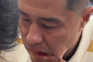 硬汉！国安足协杯夺冠后，侯森在场边默默处理嘴部伤口